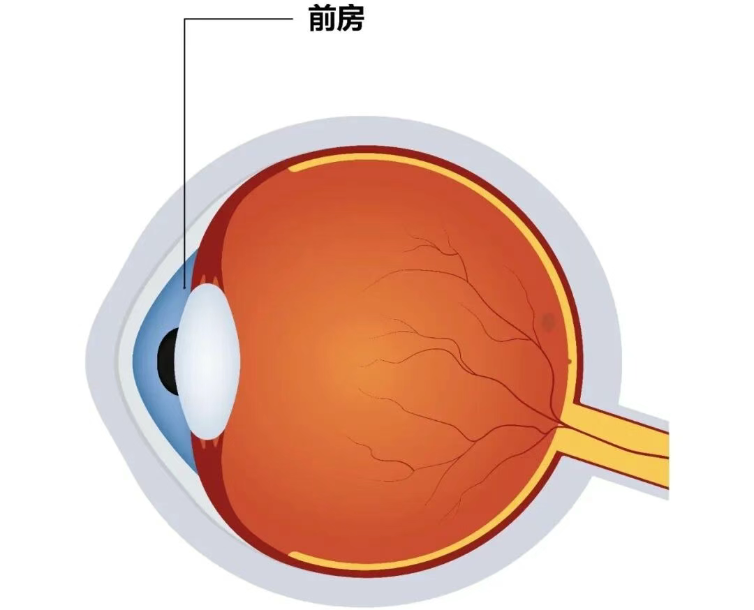 图片.png 图片.png