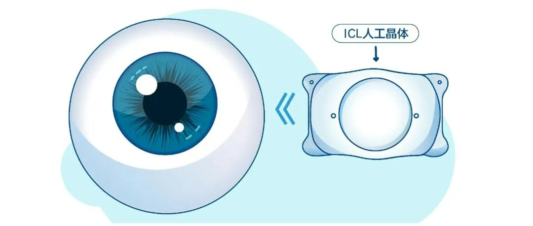 图片.png 图片.png